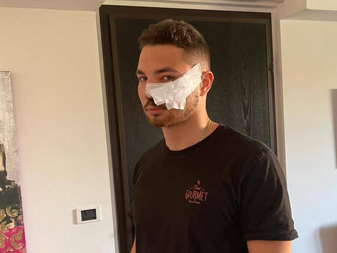 Italia. Sfregiato rider che si era fermato per aiutare una donna in pericolo. Inail concede risarcimento