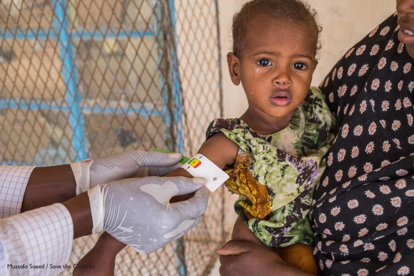 G7, emergenza cibo. Save the Children: 38% dei bambini sono gravemente malnutriti