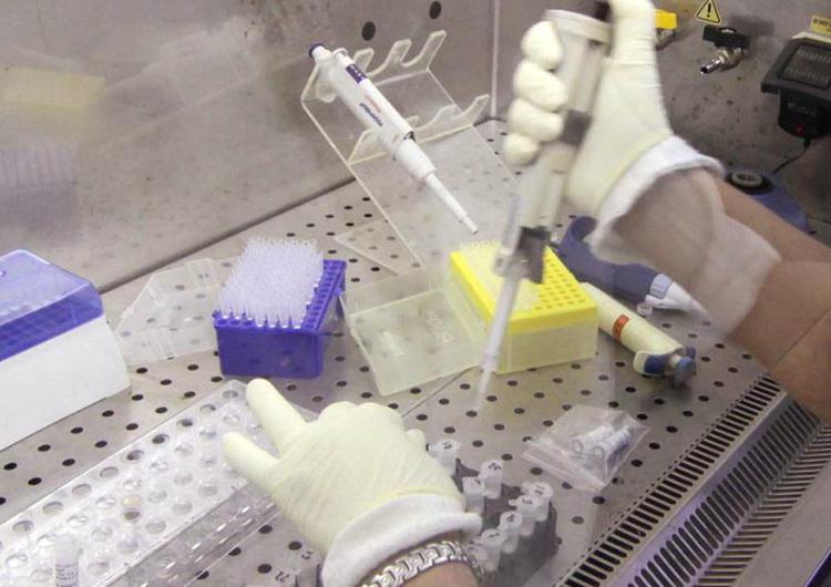 Nuovo virus identificato in Cina: “Il dato rassicurante è che non sembra avere la capacità di diffondersi da uomo a uomo e pare abbia una patogenicità relativamente bassa”