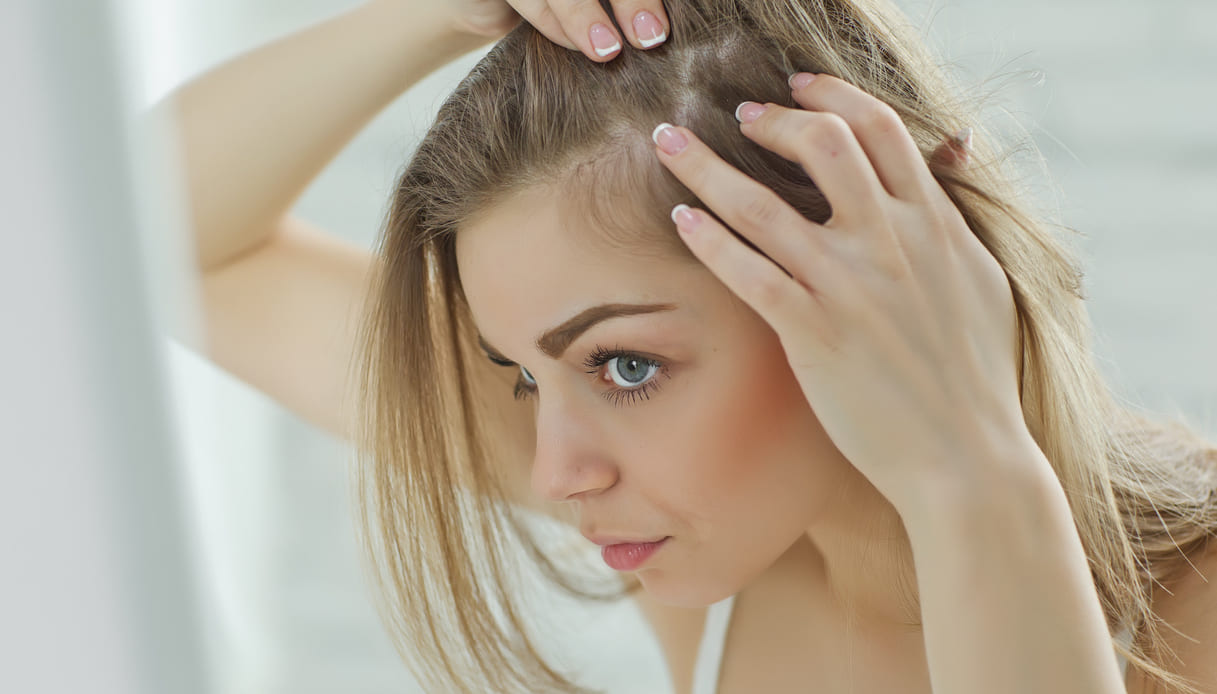 Caduta dei capelli in inverno: cause, sintomi e rimedi