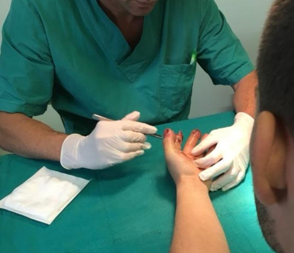 Sicilia, Capodanno: bimbo rischia di perdere la mano a Palermo. Molti i feriti anche a Catania