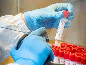 Covid Italia, contagi e morti in aumento nell’ultima settimana: bollettino e dati