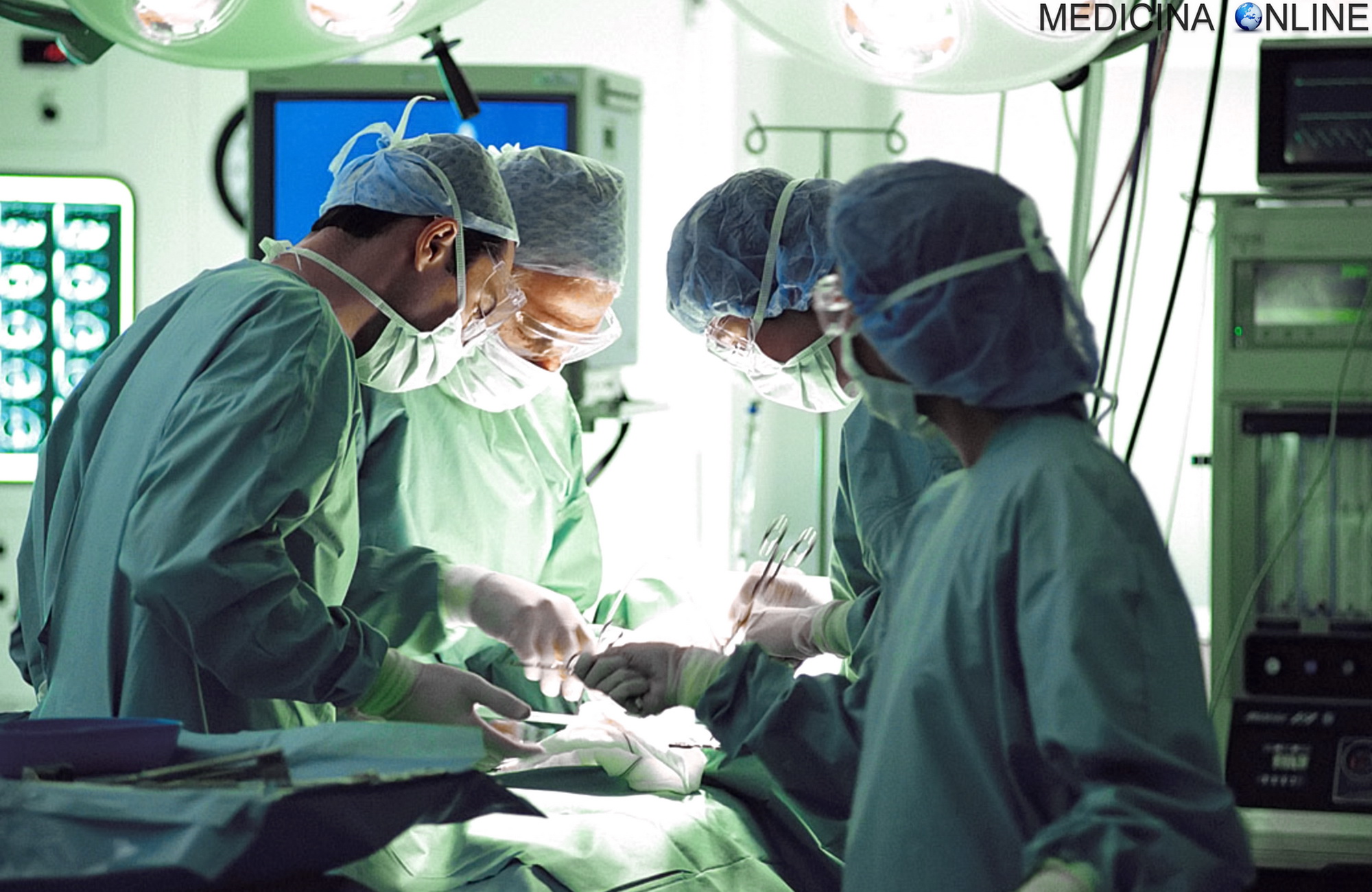 Al Giglio di Cefalù asportata in laparoscopia massa addomino-pelvica di 40 cm