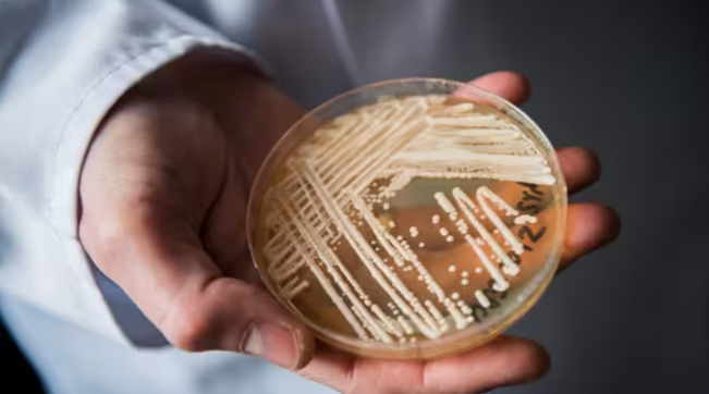 A Milano morto un uomo contagiato dalla Candida Auris, il “fungo killer”