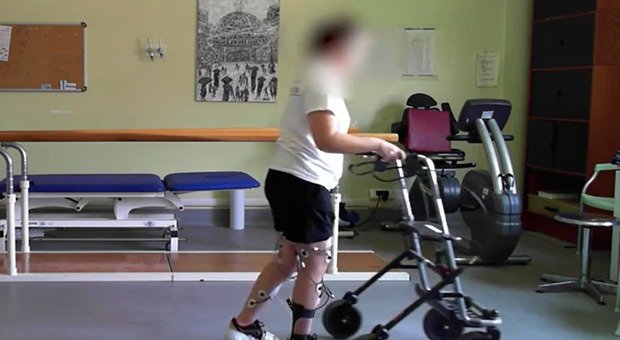 Italia, straordinario intervento: paralizzata torna a camminare grazie a neurostimolatore
