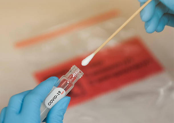 Covid, bollettino  siciliano: diffusione virale significativamente ridotta