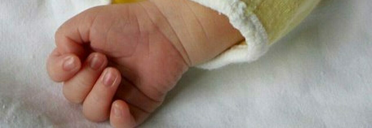 Bimbo venezuelano di 2 mesi  operato al cuore e salvato al Ccpm di Taormina