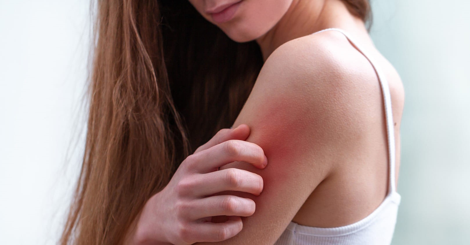 Allergica all’acqua: 25enne beve solo latte e non può lavarsi o piangere