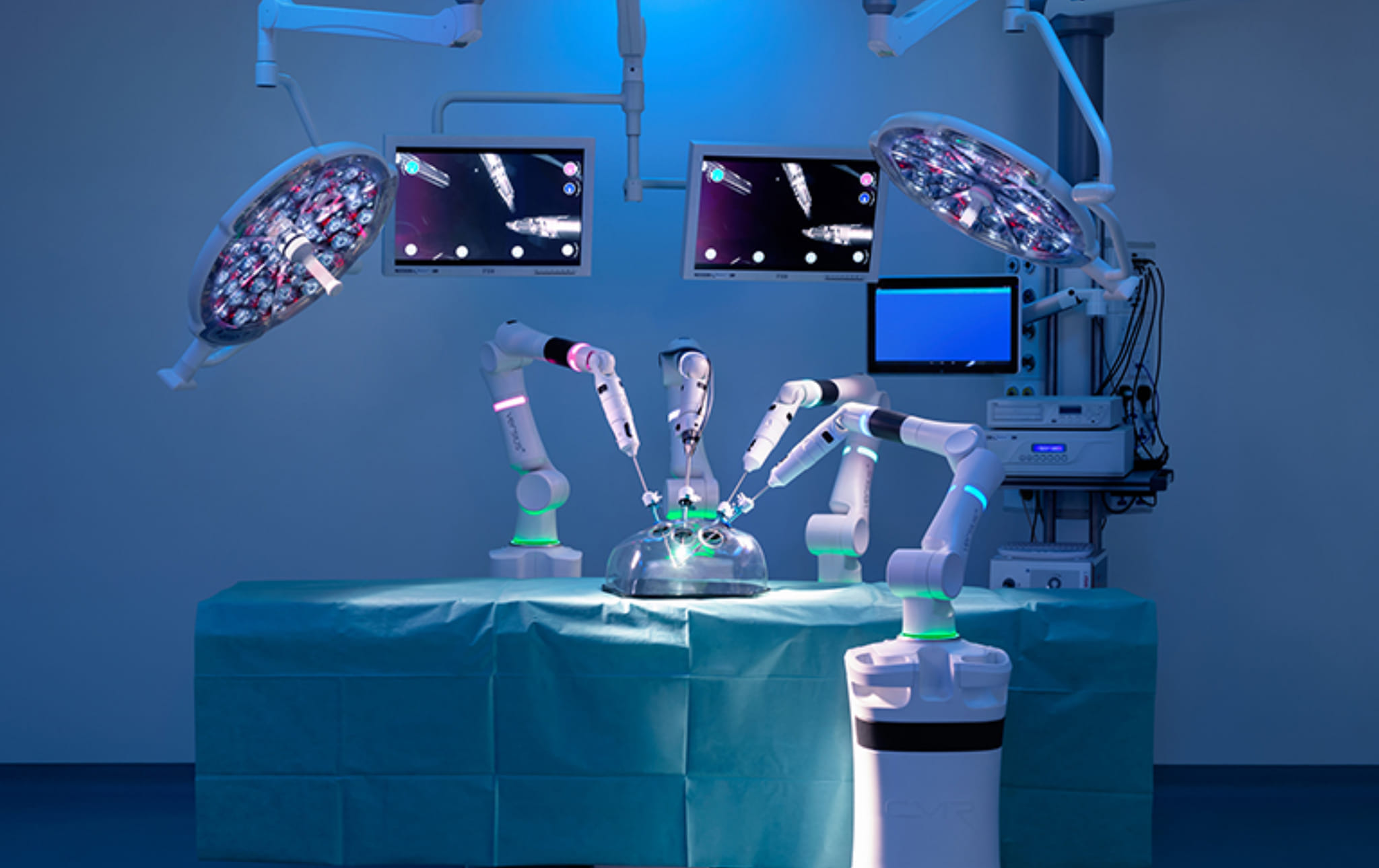 Italia, sanità all’avanguardia: al Policlinico Tor Vergata 18 trapianti rene con robot