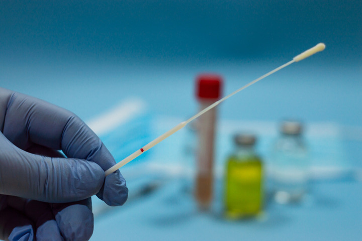 Sicilia, irregolarità nelle analisi tamponi Covid: 3 santari sospesi e 9 indagati