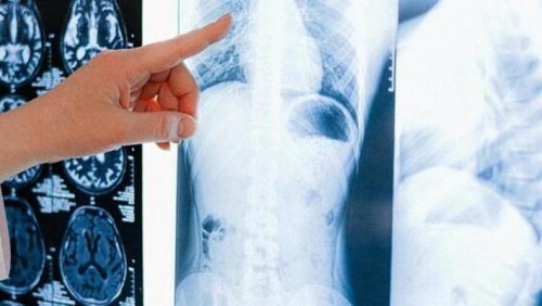 Pazienti fotografate nude: denunciato tecnico radiologo