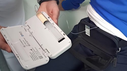 Sicilia. Trattamento del Parkinson, innovativo dispositivo sottocutaneo all’Irccs Oasi di Troina