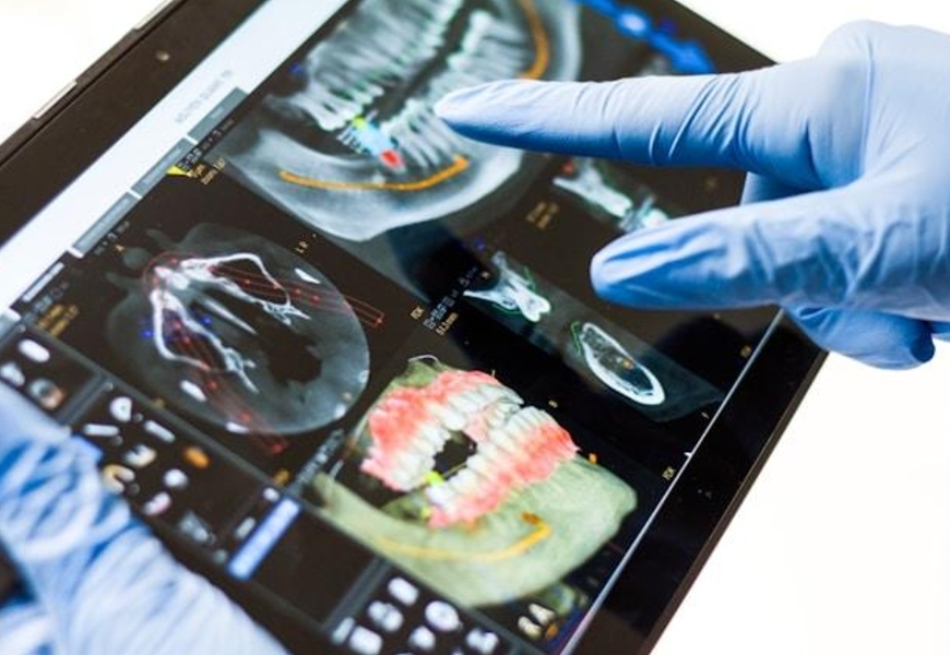 Quanto costa rifarsi i denti in Italia?