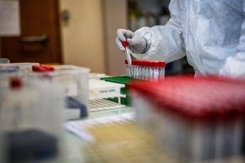 Covid, l’Aspirina frena l’attacco del virus e limita il danno ai polmoni: l’ultimo studio