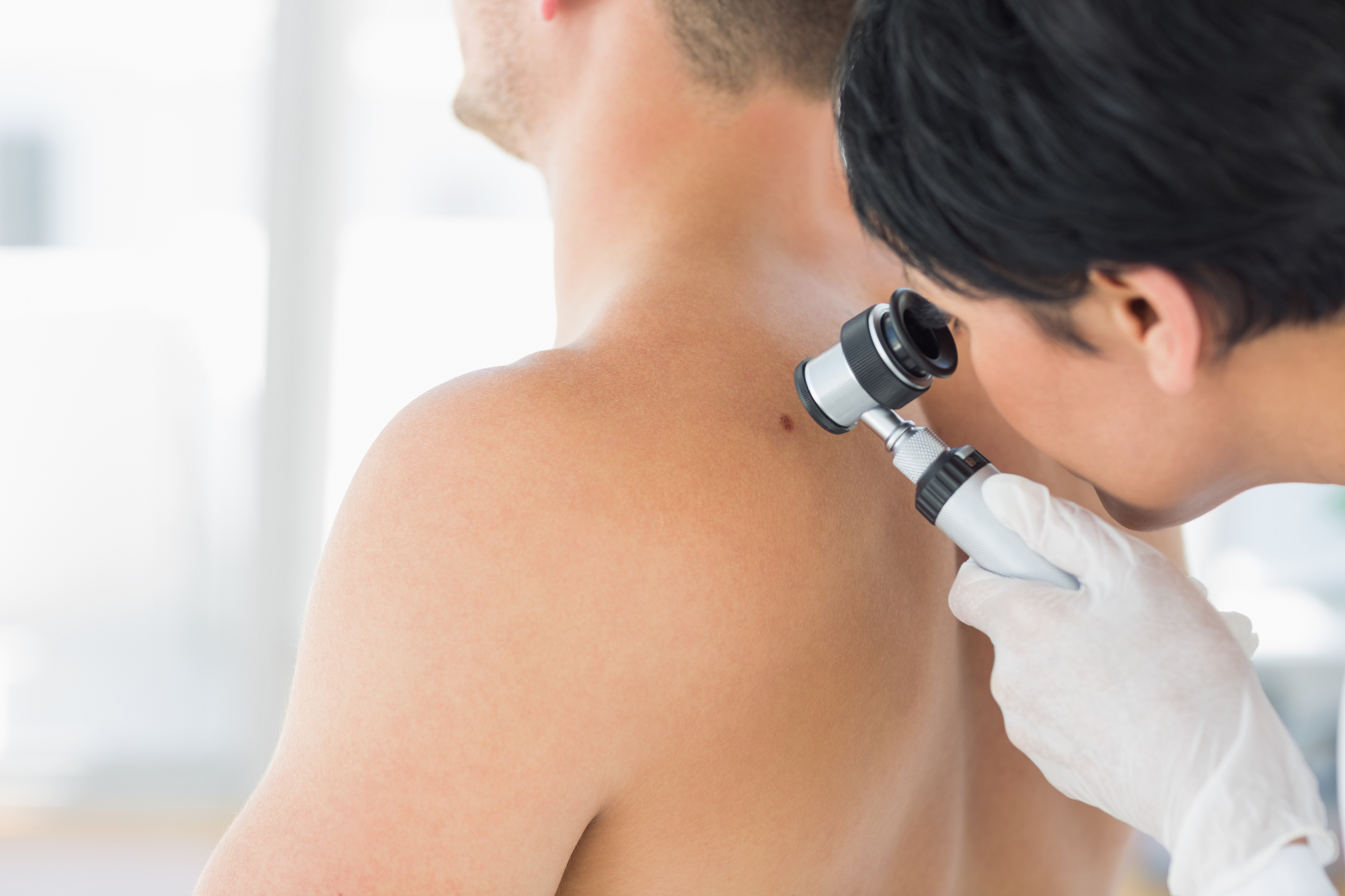 Il melanoma in Sicilia, i bisogni dei pazienti: più prevenzione e supporto psicologico