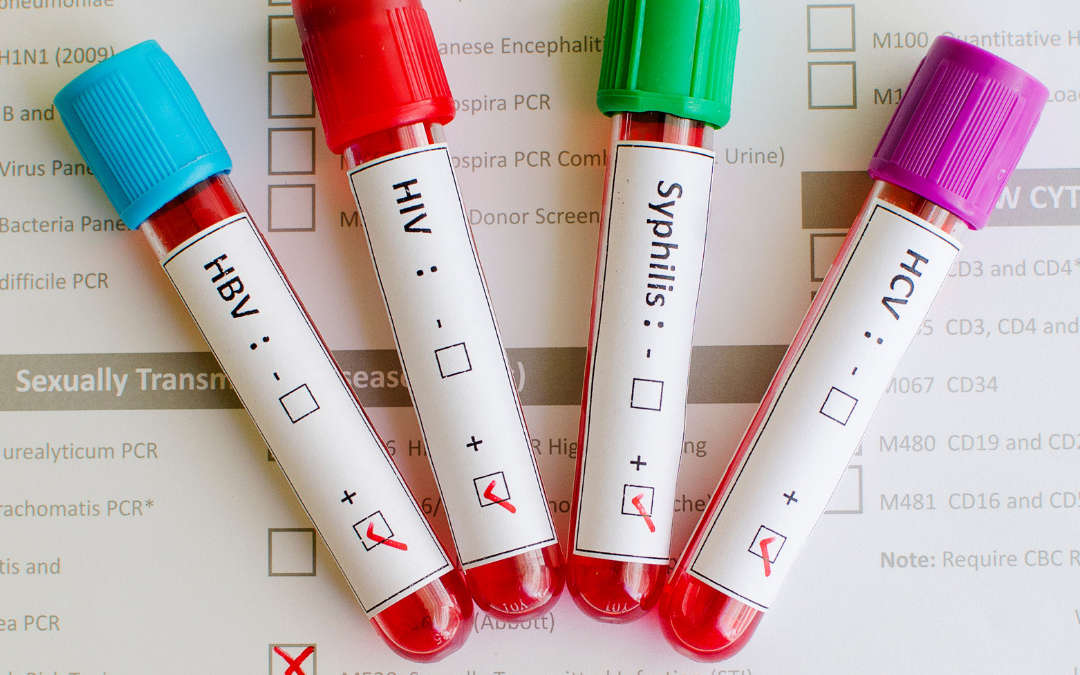 San Cataldo. Il 12 febbraio presso la sede del Rotary convegno su prevenzione malattie sessualmente trasmissibili