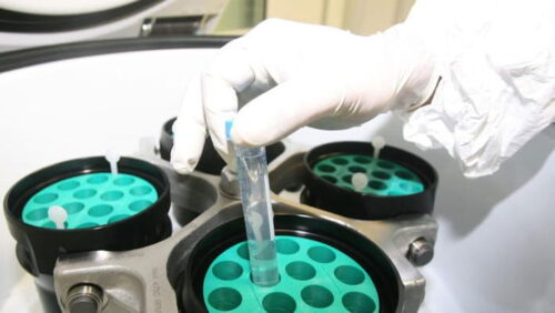 Sommatino. Il 28 marzo ci si può sottoporre ad esame per la prevenzione del carcinoma al colon