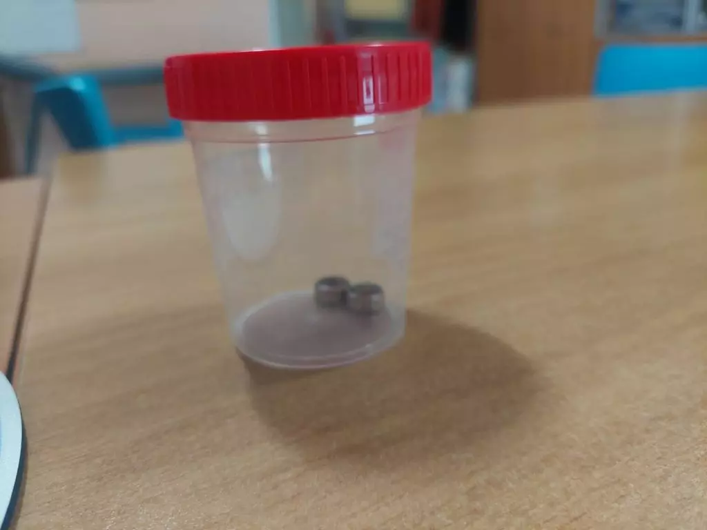 Ingerisce due batterie a bottone, bambina di un anno operata