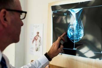 Cancro al seno, crioablazione nuova frontiera di cura