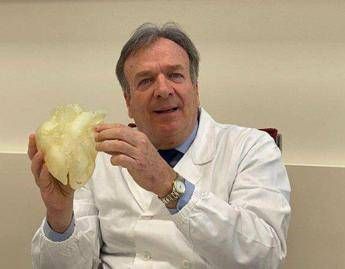 Medicina: prima mondiale a Padova, esiti infezione aspirati da aorta a cuore battente