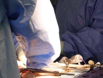 Roma, muore a 62 anni dopo liposuzione in una clinica privata