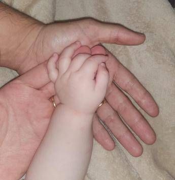 Roma, salvata neonata da tumore con tecnica mini-invasiva su misura