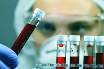 Oncoematologa Patti: “Bene pirtobrutinib in Llc, in Sicilia oltre 200 diagnosi l’anno”