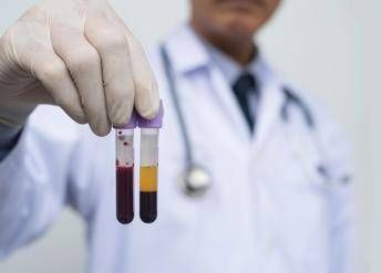 Ricerca, allo studio analisi sangue a casa e test cerebrali online per scoprire rischio demenza