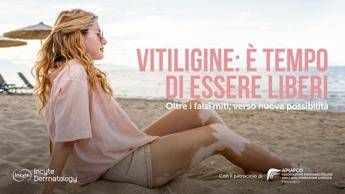 Salute, Giornata vitiligine: al via campagna ‘Oltre falsi miti verso nuove possibilità’