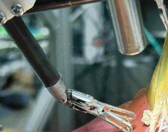 Il ‘dottor robot’ opera da solo, primo intervento senza aiuto umano