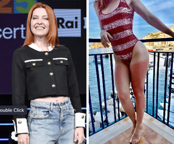 Dalla chioma alle gambe, Noemi ironizza sulla scottatura: “Mai senza crema”