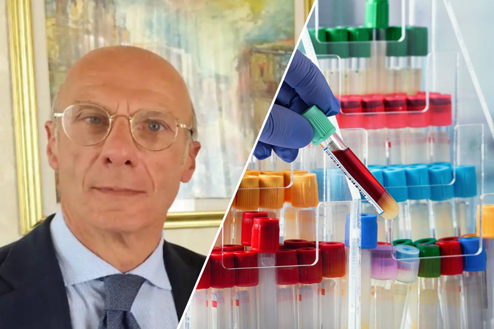 Chiusura contemporanea dei centri analisi.  Tesauro: “Necessaria una turnazione per garantire il servizio”