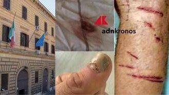 “Picchiato e sequestrato per due giorni da altri detenuti a Regina Coeli”, la denuncia choc