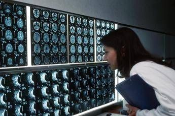 Radiologi Sirm: “Attenzione a medicina difensiva ed esami inappropriati”