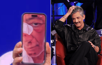 Fiorello, l’incidente in bicicletta: “Volevo fare il figo… sono caduto di faccia”