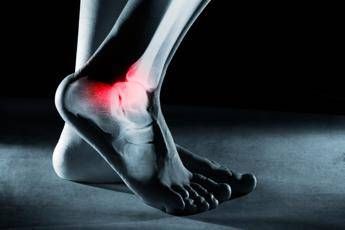 Ossa fragili dei calciatori, ecco perché post ritiro tanti soffrono di osteoartrite