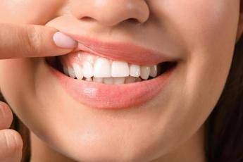 Diabete, parodontologi ‘malattie gengivali complicano il tipo 2’