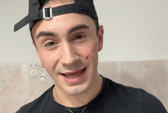 Genova, 19enne denuncia aggressione omofoba: “Sfregiato al viso con coltellino”