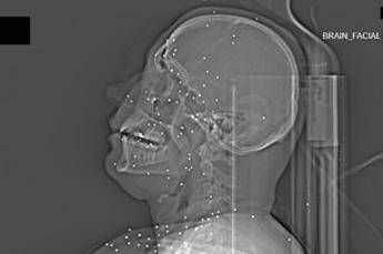 L’inchiesta horror sulle violenze iraniane: ‘Manifestanti uccisi e colpiti nelle parti vitali’