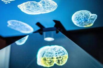 Ictus, ecco come l’emisfero sano del cervello influenza la ripresa: la ricerca rivoluzionaria