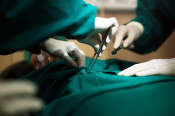 Eccezionale intervento chirurgico: asportato fibroma dell’utero dal peso di circa 16 kg
