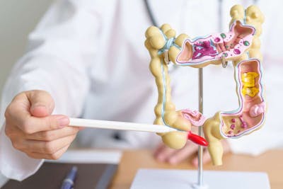 L’Asp di Caltanissetta promuove lo screening gratuito per la diagnosi precoce del tumore del colon-retto