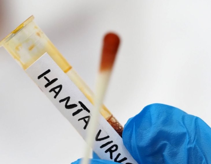 Hantavirus, il Ministero della Salute conferma: “Non risultano casi registrati in Italia”