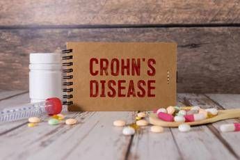 Malattia Crohn con fistole, nuovi dati su terapia monoclonale