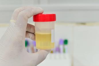 Dai segnali del colore alla postura, sui social è ‘urina mania’ tra scienza e falsi miti