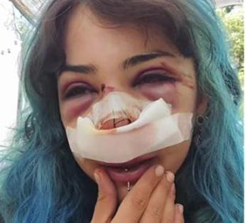 Bari, studentessa picchiata al parco: indagati per lesioni e rapina custode bagni e il compagno